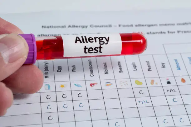 Why Allergy Testing Is Important __ Life Aid
